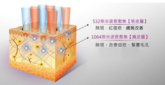 祛痘我用點陣，你呢？！