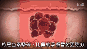 皮秒激光儀器的一些問(wèn)題的解答！