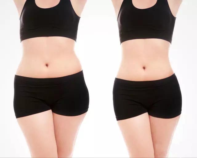 UltraShape優(yōu)立塑非侵入式專利科技、有效、安全！